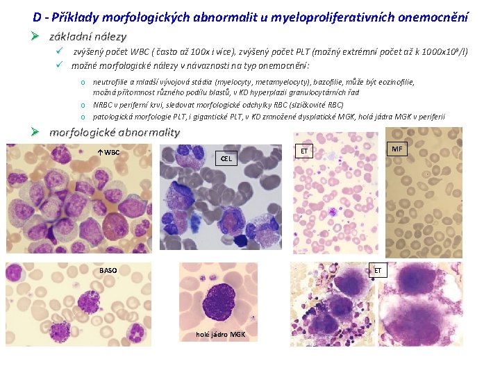 D - Příklady morfologických abnormalit u myeloproliferativních onemocnění Ø základní nálezy ü zvýšený počet