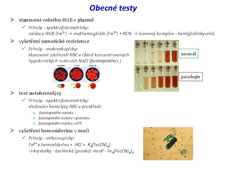 Obecné testy Ø stanovení volného HGB v plazmě ü Princip - spektrofotometricky: oxidace HGB