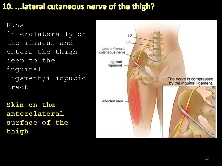 10. . lateral cutaneous nerve of the thigh? Runs. inferolaterally on the iliacus and