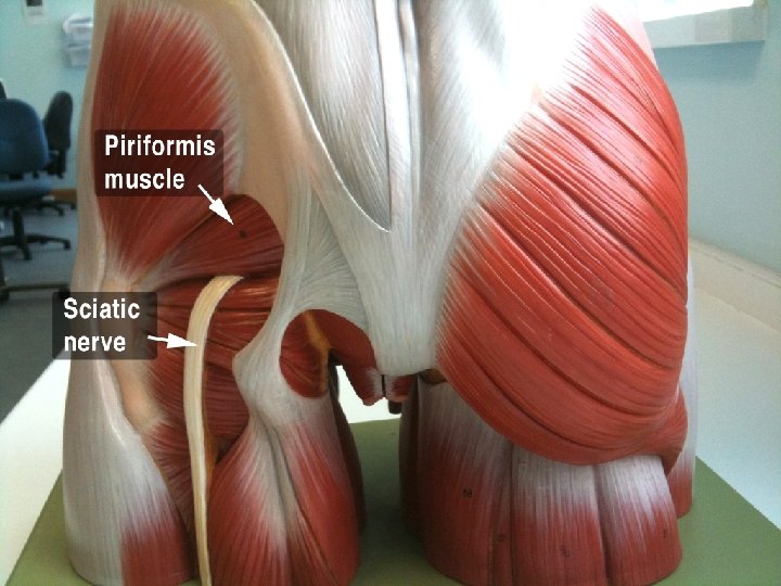 13. . . sciatic nerve? o Largest nerve in the body. . o The