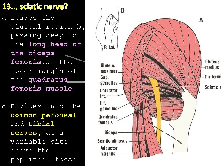 13. . . sciatic nerve? o Leaves the. gluteal region by passing deep to