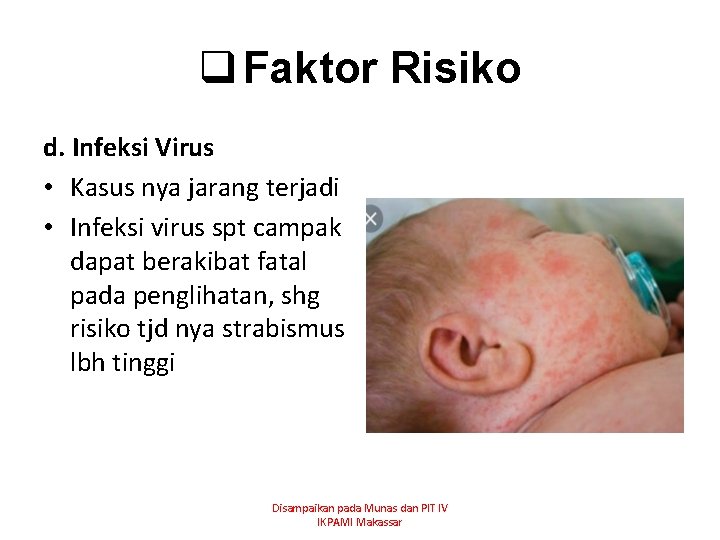 q Faktor Risiko d. Infeksi Virus • Kasus nya jarang terjadi • Infeksi virus