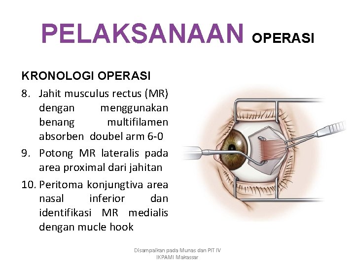 PELAKSANAAN OPERASI KRONOLOGI OPERASI 8. Jahit musculus rectus (MR) dengan menggunakan benang multifilamen absorben