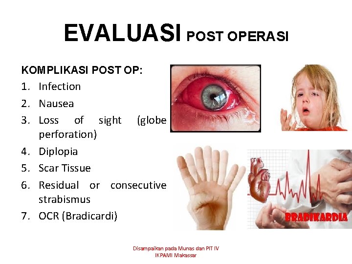 EVALUASI POST OPERASI KOMPLIKASI POST OP: 1. Infection 2. Nausea 3. Loss of sight