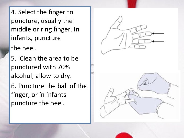 4. Select the finger to puncture, usually the middle or ring finger. In infants,