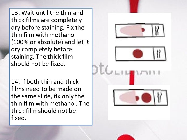 13. Wait until the thin and thick films are completely dry before staining. Fix