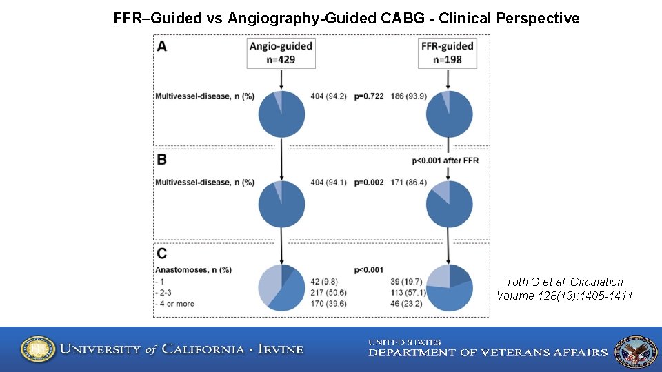 FFR–Guided vs Angiography-Guided CABG - Clinical Perspective Toth G et al. Circulation Volume 128(13):