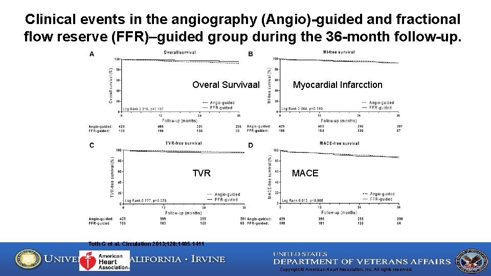 Clinical events in the angiography (Angio)-guided and fractional flow reserve (FFR)–guided group during the