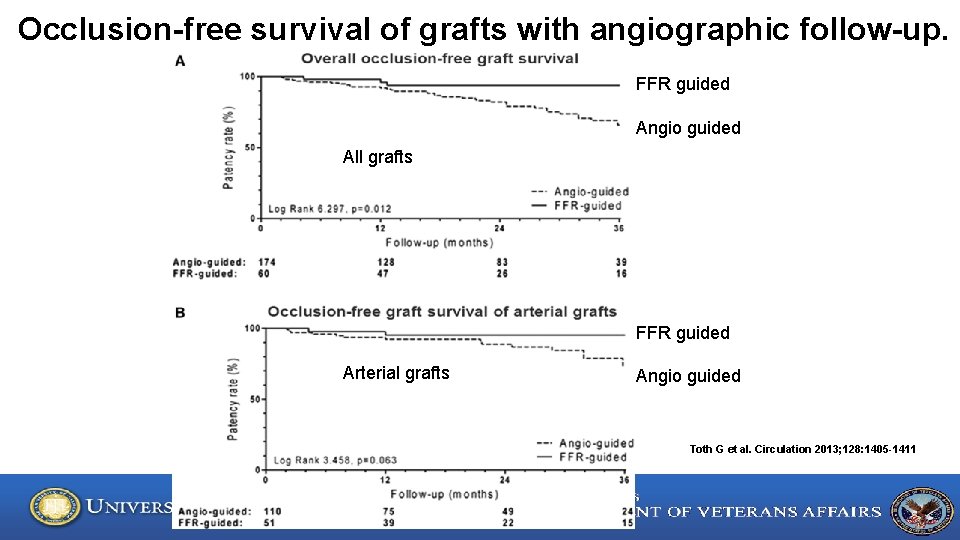 Occlusion-free survival of grafts with angiographic follow-up. FFR guided Angio guided All grafts FFR