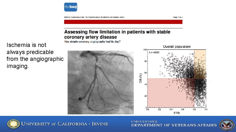 Ischemia is not always predicable from the angiographic imaging. 