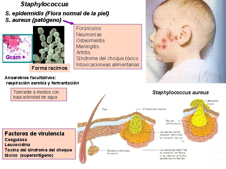 Staphylococcus S. epidermidis (Flora normal de la piel) S. aureus (patógeno) Gram + Forma