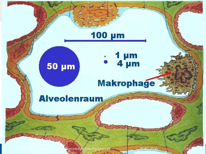 abc 100 µm abc . 1 µm 4 µm 50 µm Makrophage Alveolenraum Dr.