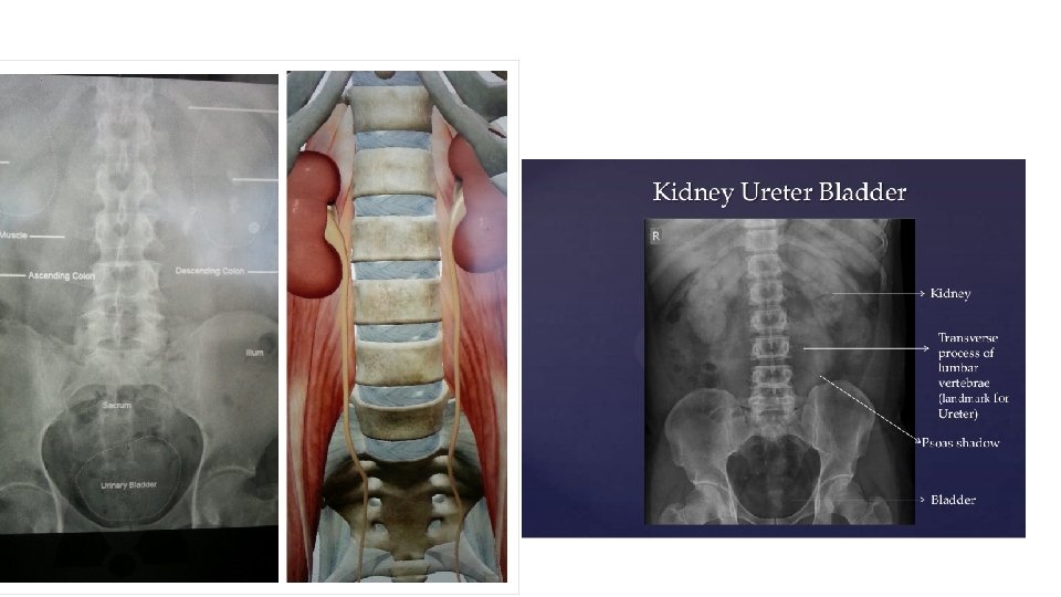 Ureter 