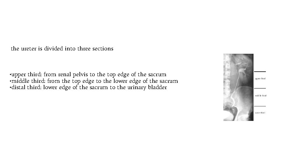  the ureter is divided into three sections • upper third: from renal pelvis
