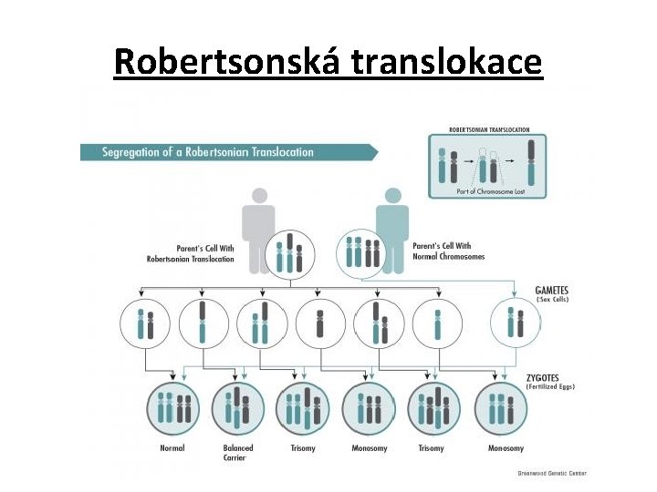 Robertsonská translokace 