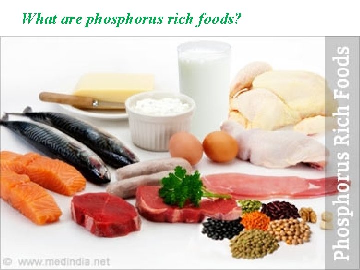 What are phosphorus rich foods? 