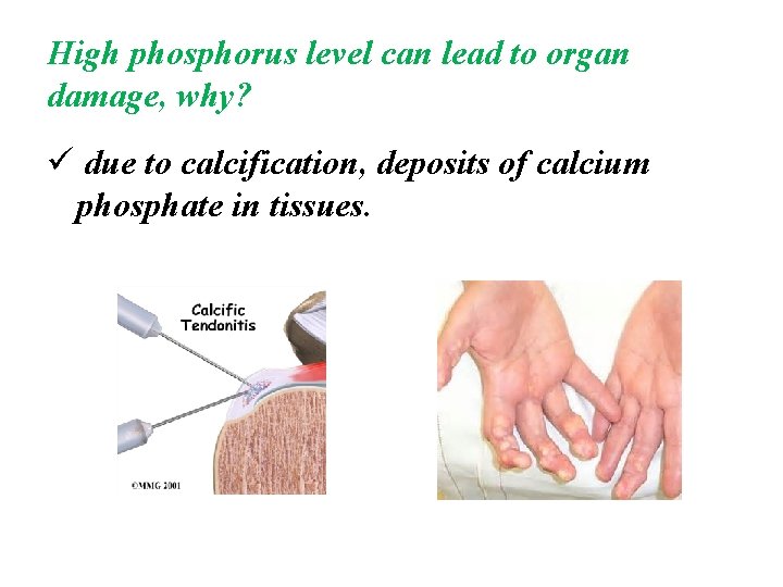 High phosphorus level can lead to organ damage, why? ü due to calcification, deposits