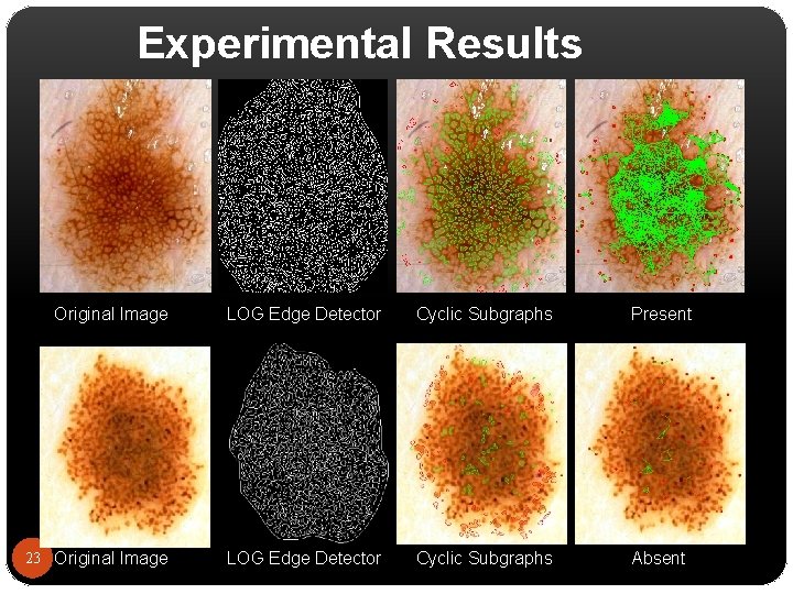 Experimental Results Original Image LOG Edge Detector Cyclic Subgraphs Present 23 Original Image LOG