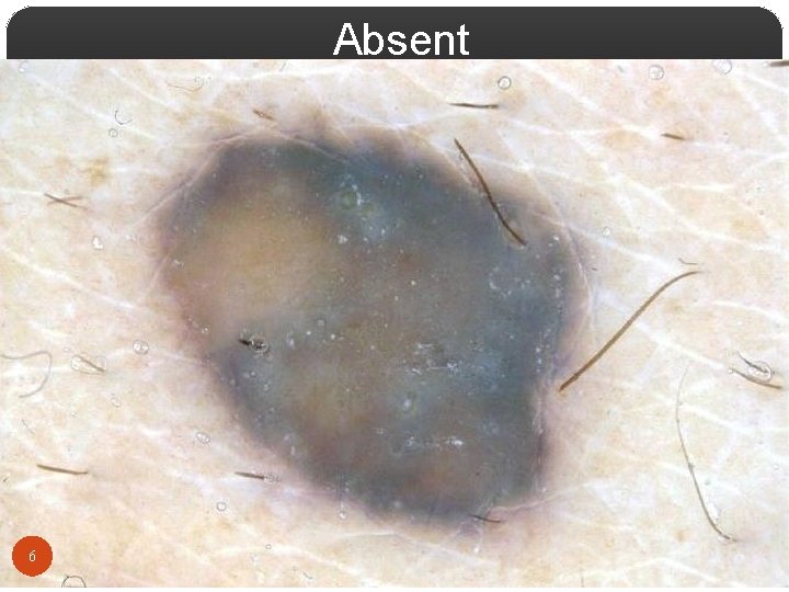 Absent 6 