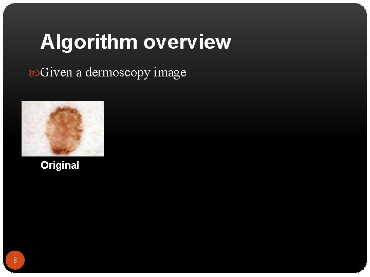Algorithm overview Given a dermoscopy image Original 8 
