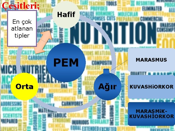 Çeşitleri; En çok atlanan tipler Hafif PEM Orta MARASMUS Ağır KUVASHi. ORKOR MARASMi. KKUVASHİORKOR