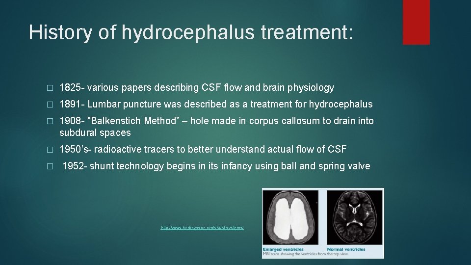 History of hydrocephalus treatment: � 1825 - various papers describing CSF flow and brain