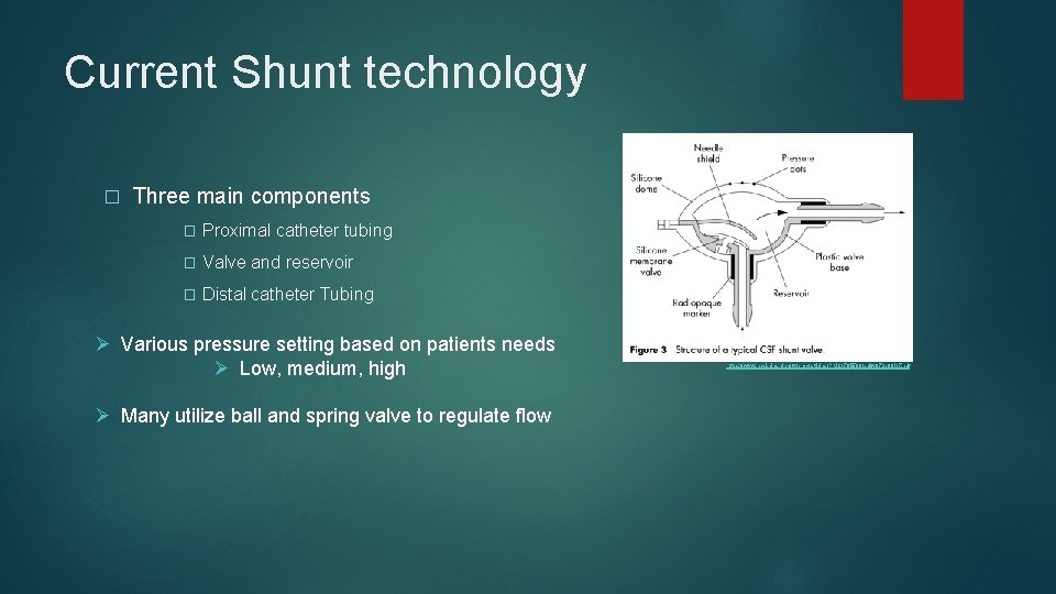 Current Shunt technology � Three main components � Proximal catheter tubing � Valve and