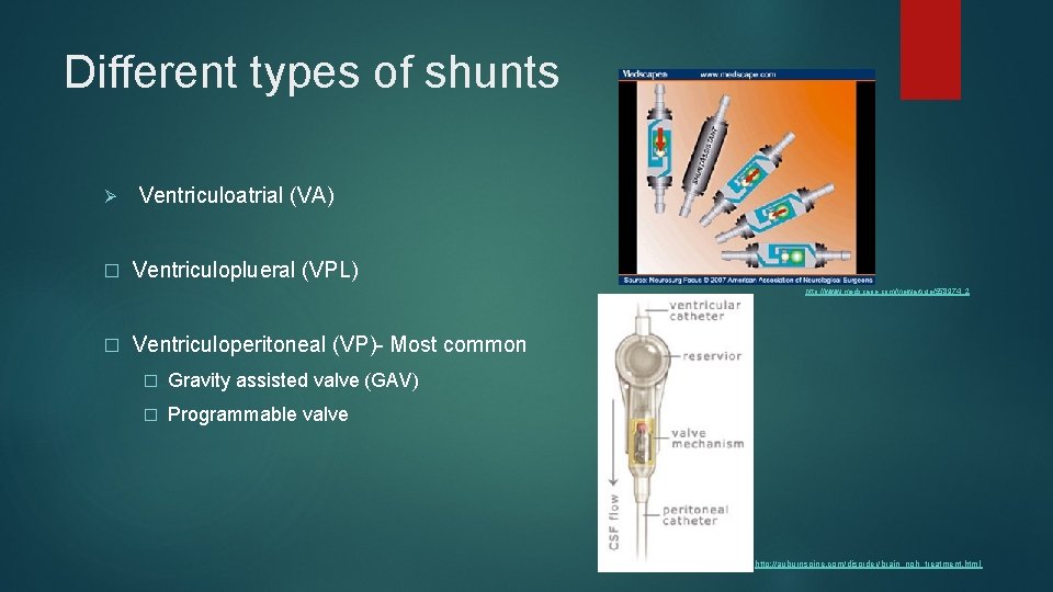 Different types of shunts Ø � Ventriculoatrial (VA) Ventriculoplueral (VPL) http: //www. medscape. com/viewarticle/558974_2