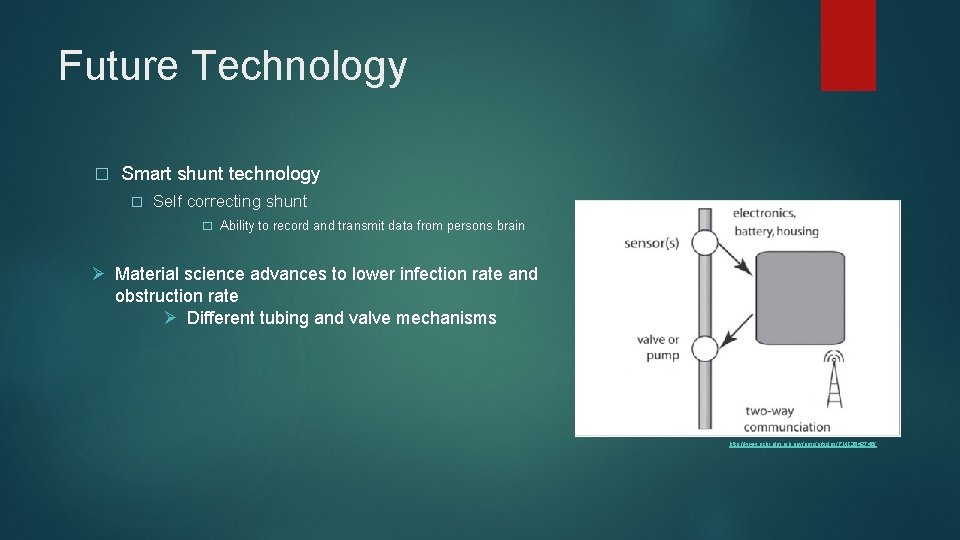 Future Technology � Smart shunt technology � Self correcting shunt � Ability to record