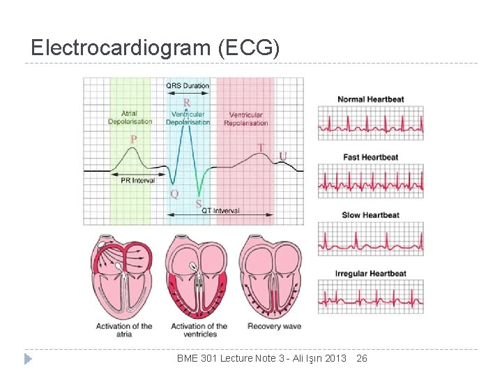 Electrocardiogram (ECG) BME 301 Lecture Note 3 - Ali Işın 2013 26 