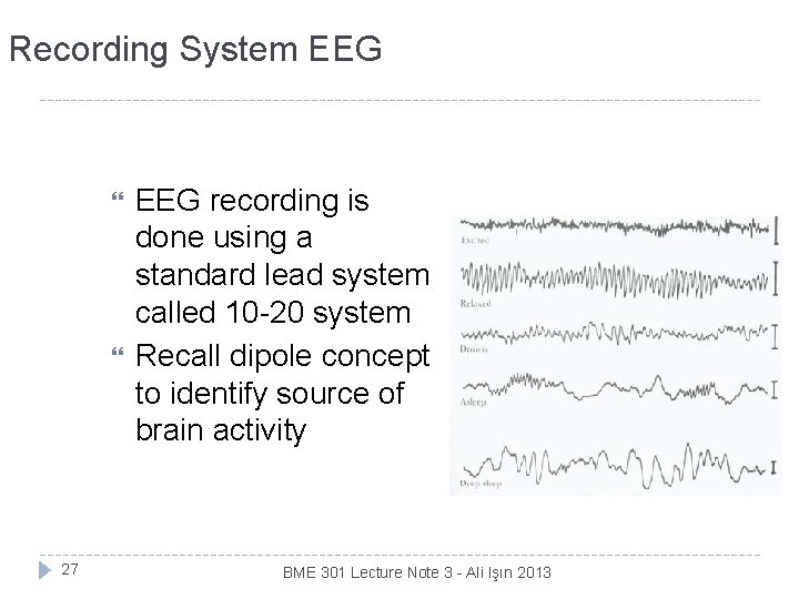 Recording System EEG 27 EEG recording is done using a standard lead system called