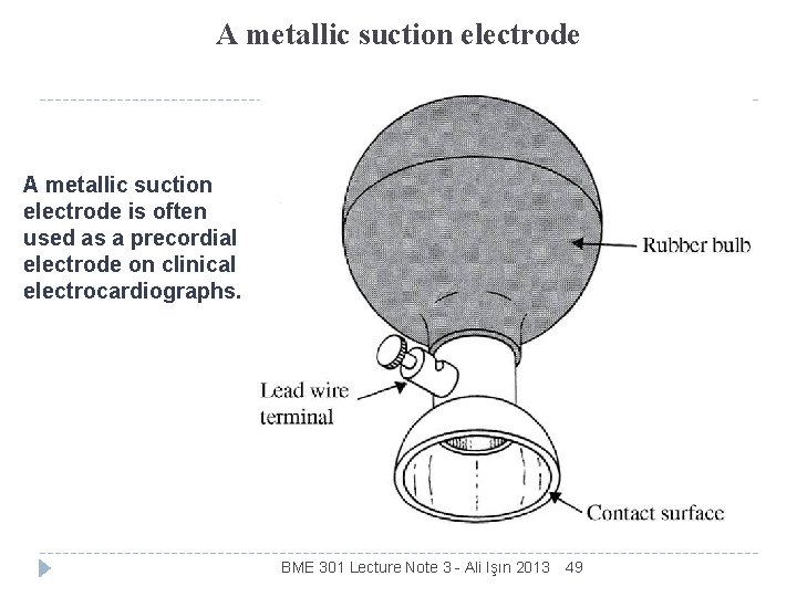 A metallic suction electrode is often used as a precordial electrode on clinical electrocardiographs.