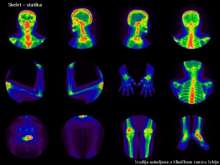 Skelet – statika Studija snimljena u Kliničkom centru Srbije 