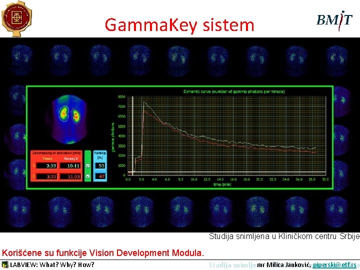 Pljuvačne žlezde-dinamika Gamma. Key sistem Studija snimljena u Kliničkom centru Srbije Korišćene su funkcije