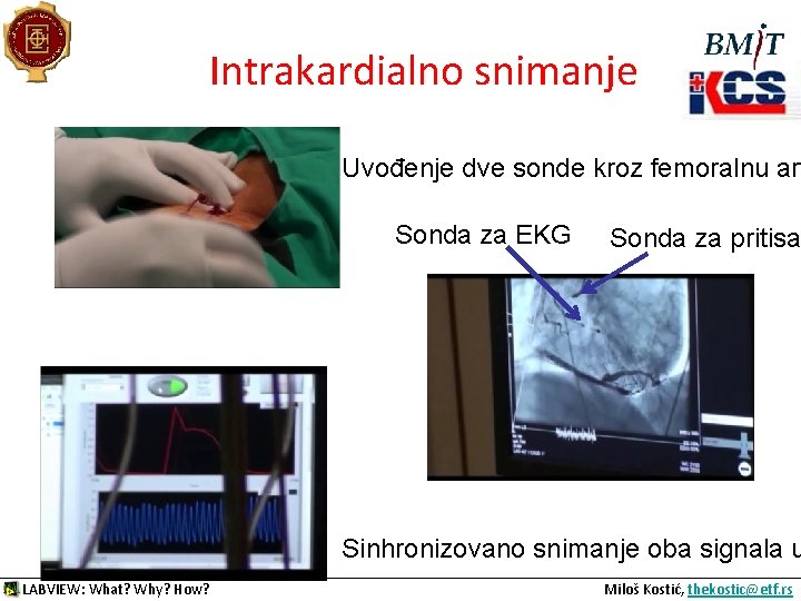 Intrakardialno snimanje Uvođenje dve sonde kroz femoralnu art Sonda za EKG Sonda za pritisa