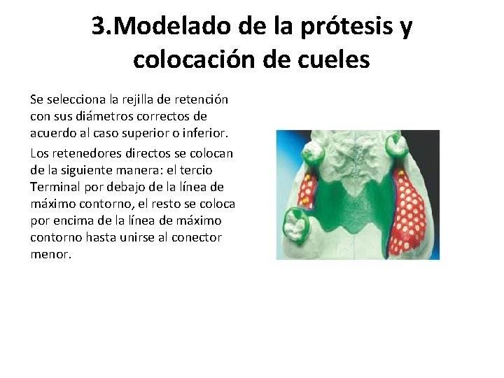 3. Modelado de la prótesis y colocación de cueles Se selecciona la rejilla de