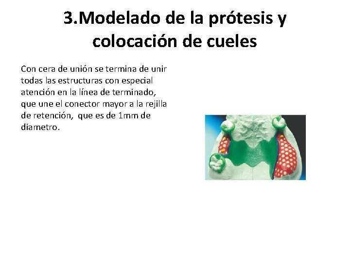 3. Modelado de la prótesis y colocación de cueles Con cera de unión se