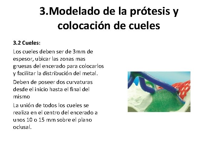 3. Modelado de la prótesis y colocación de cueles 3. 2 Cueles: Los cueles