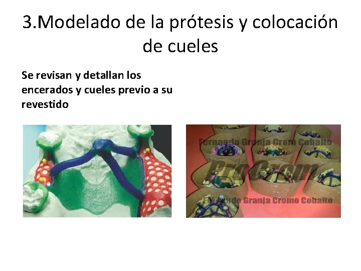 3. Modelado de la prótesis y colocación de cueles Se revisan y detallan los