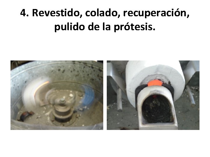 4. Revestido, colado, recuperación, pulido de la prótesis. 