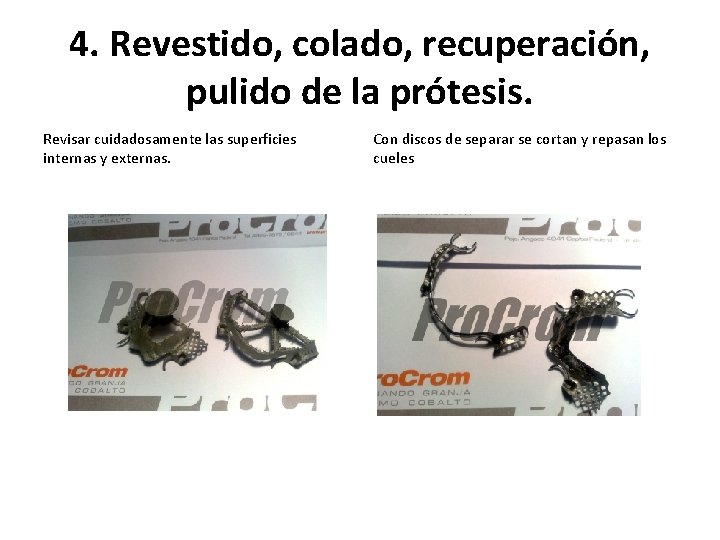 4. Revestido, colado, recuperación, pulido de la prótesis. Revisar cuidadosamente las superficies internas y