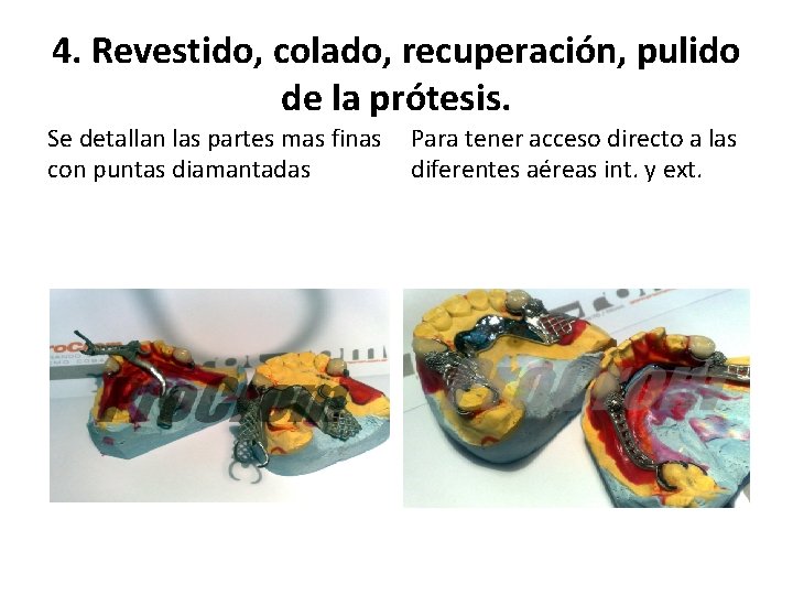 4. Revestido, colado, recuperación, pulido de la prótesis. Se detallan las partes mas finas