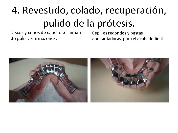 4. Revestido, colado, recuperación, pulido de la prótesis. Discos y conos de caucho terminan