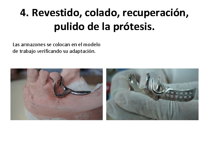 4. Revestido, colado, recuperación, pulido de la prótesis. Las armazones se colocan en el