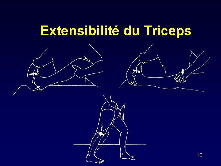 Extensibilité du Triceps 12 