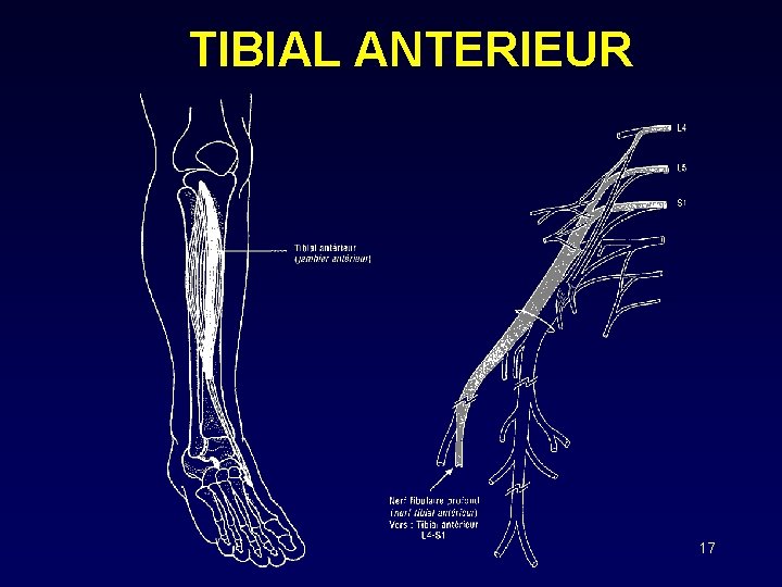 TIBIAL ANTERIEUR 17 