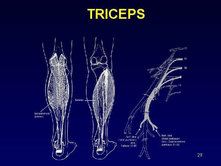 TRICEPS 29 