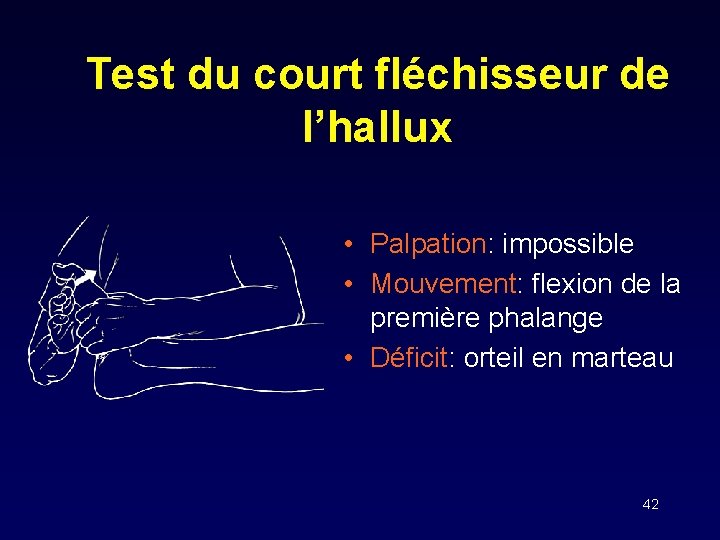 Test du court fléchisseur de l’hallux • Palpation: impossible • Mouvement: flexion de la