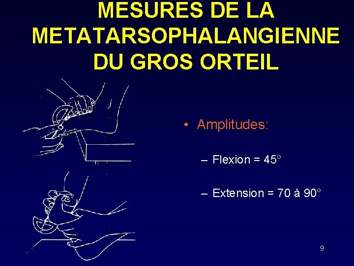 MESURES DE LA METATARSOPHALANGIENNE DU GROS ORTEIL • Amplitudes: – Flexion = 45° –