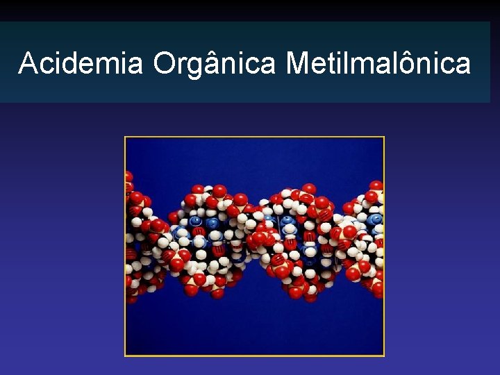 Acidemia Orgânica Metilmalônica 